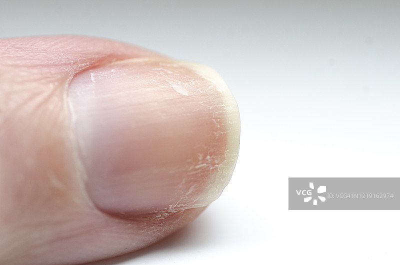 干燥的钉子图片素材