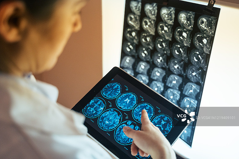 年轻女外科医生检查头部CT扫描和肩部MRI扫描图片素材