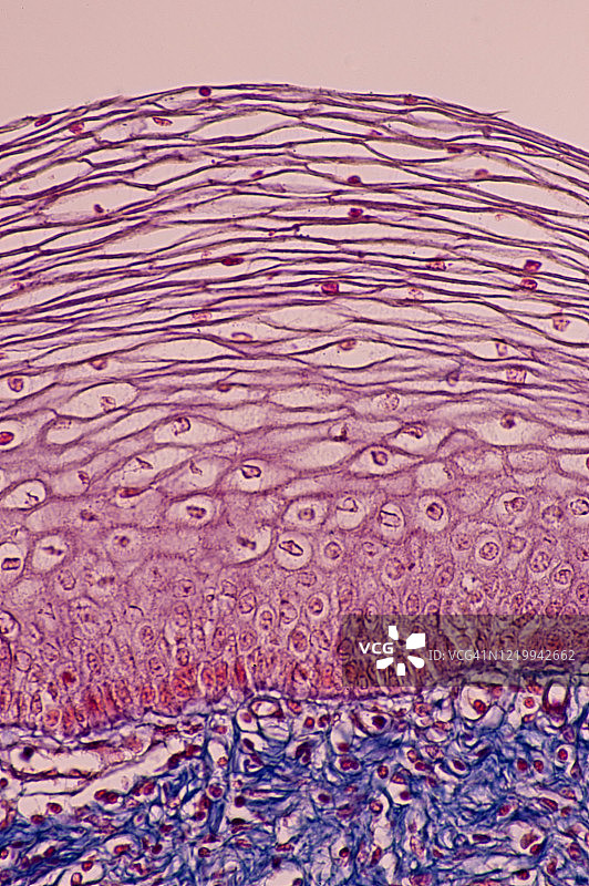 人阴道---复层鳞状上皮，100倍图片素材