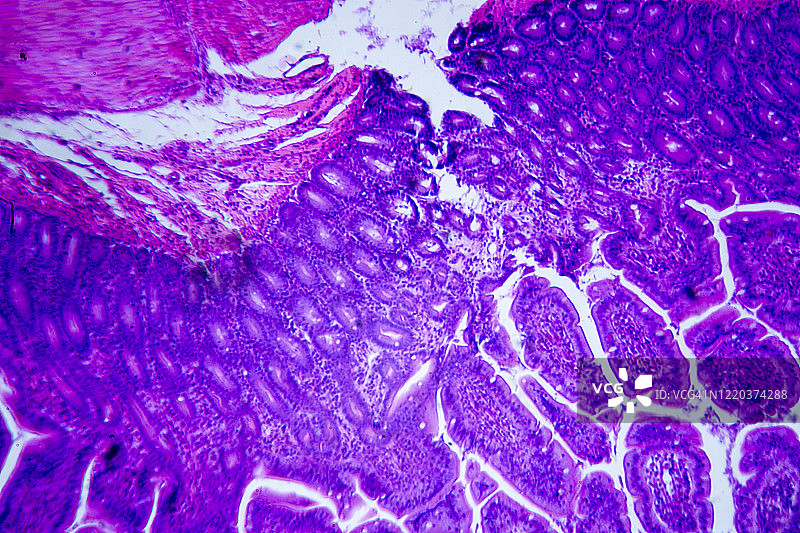 小肠横截面显微图像图片素材
