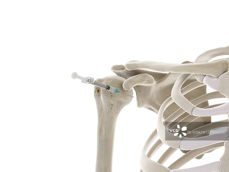 肩部注射插图图片素材