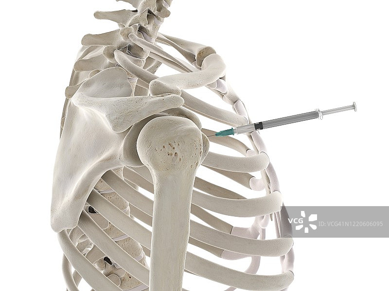 肩部注射插图图片素材