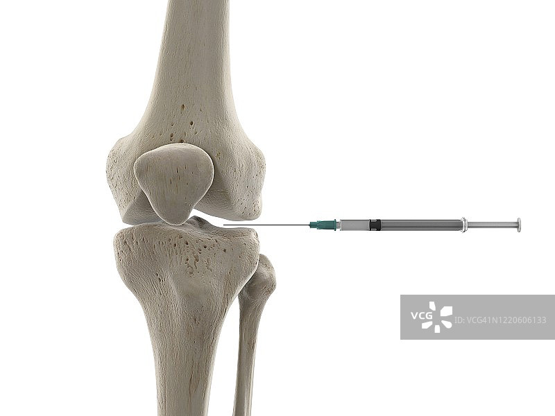 膝关节注射插画图片素材