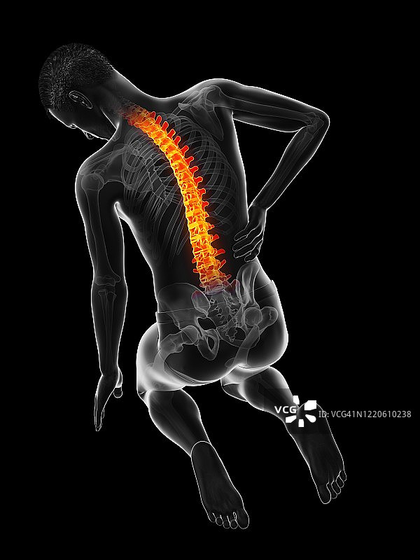 急性背痛插图图片素材