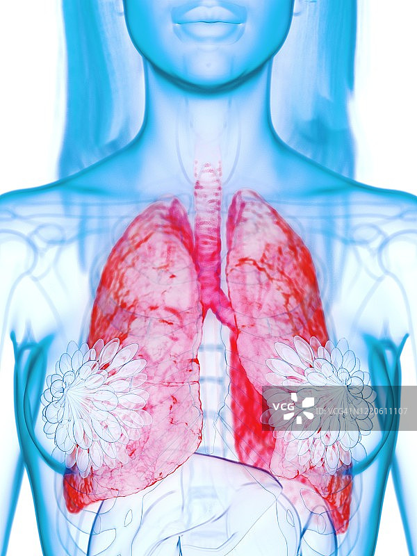 病变的肺部插图图片素材