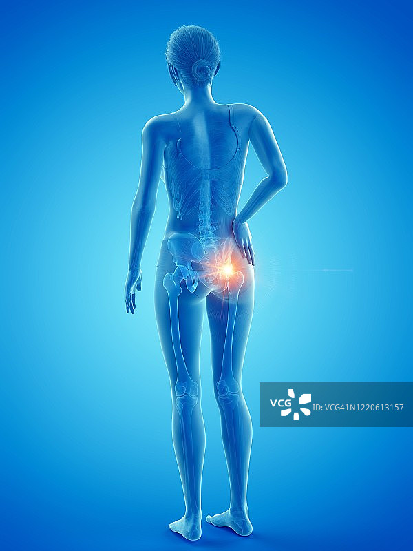 臀部疼痛的女人插画图片素材