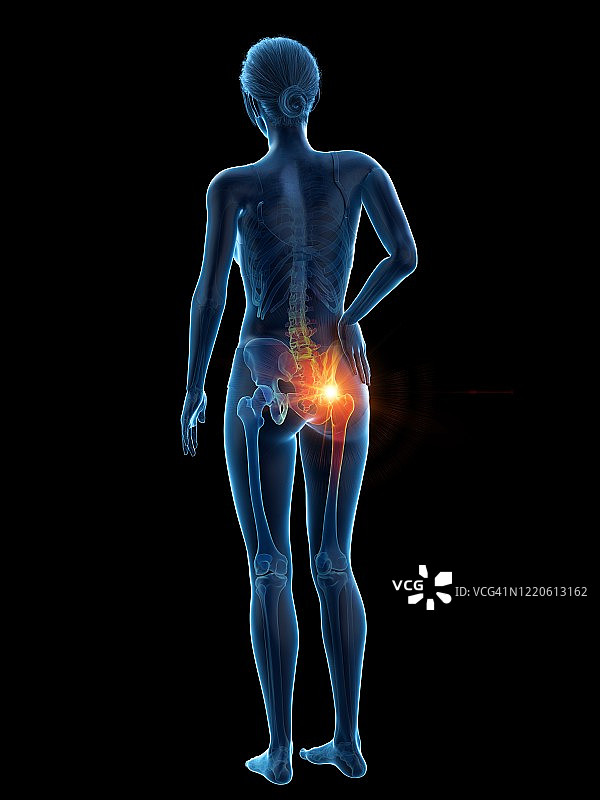 臀部疼痛的女人插画图片素材