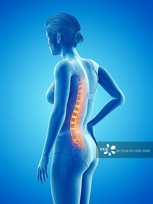 背部疼痛的女人，插图图片素材