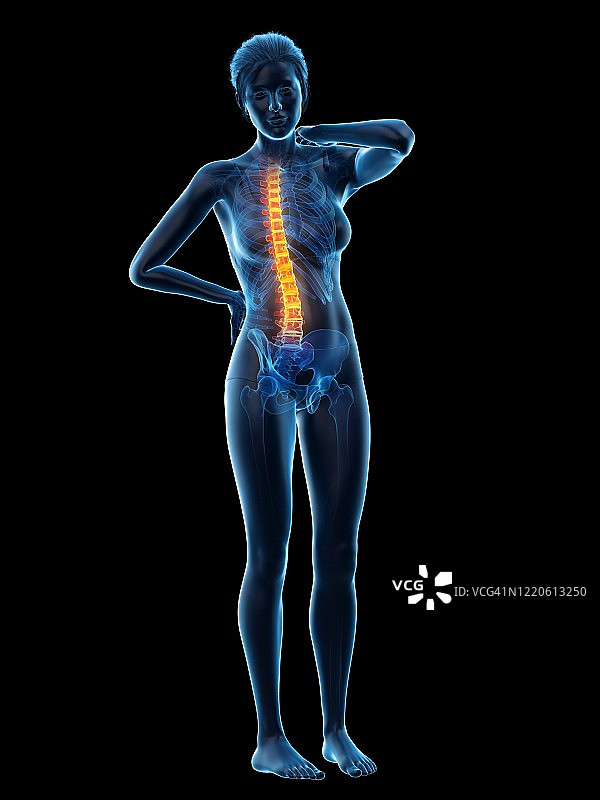 背痛的女人插画图片素材