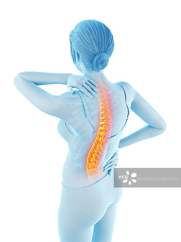 背痛的女人插画图片素材