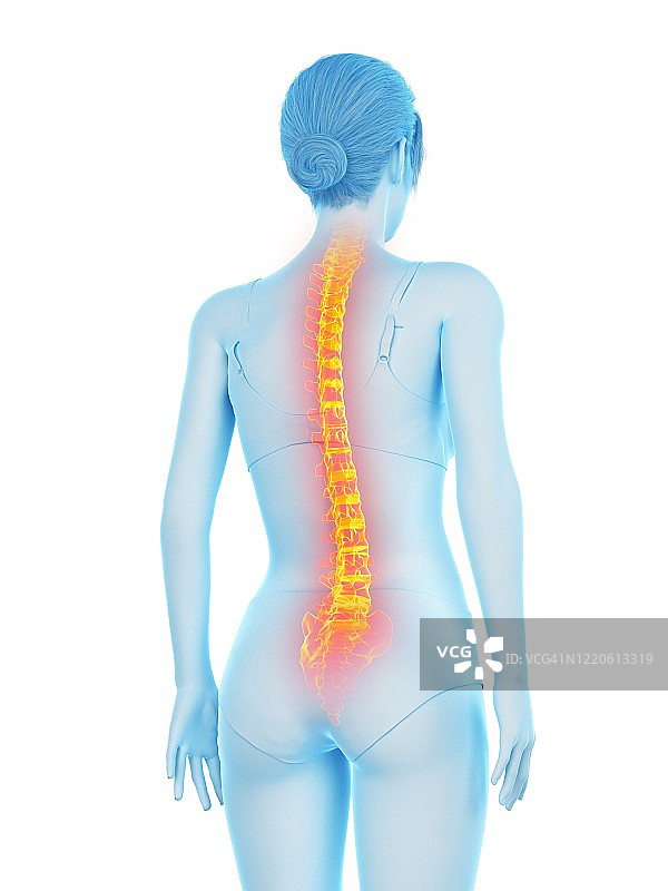 背痛的女人插画图片素材