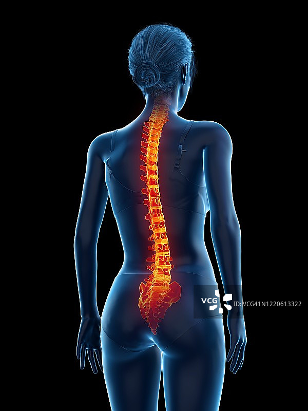 背痛的女人插画图片素材