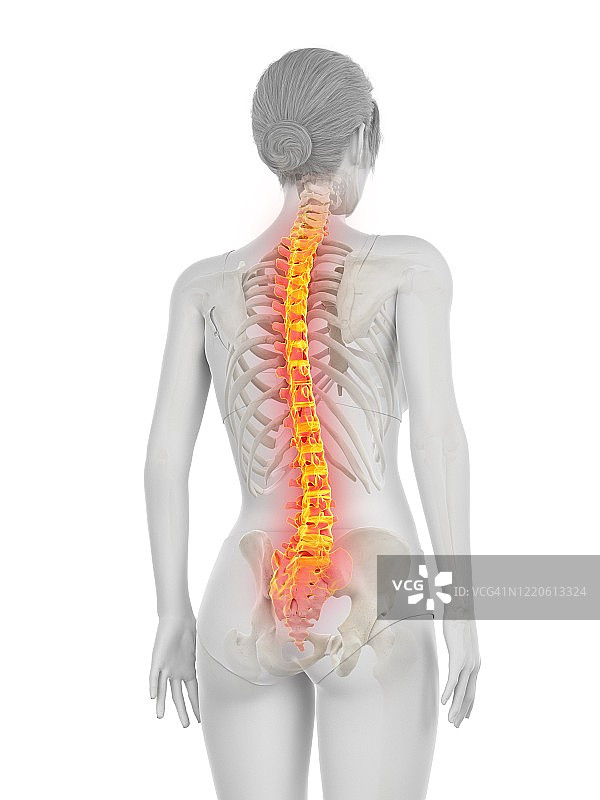 背痛的女人插画图片素材