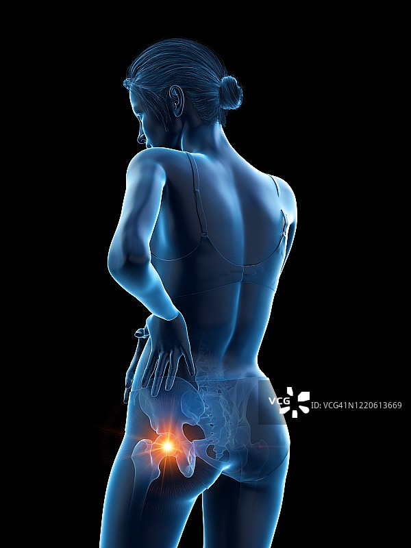 臀部疼痛的女人插画图片素材