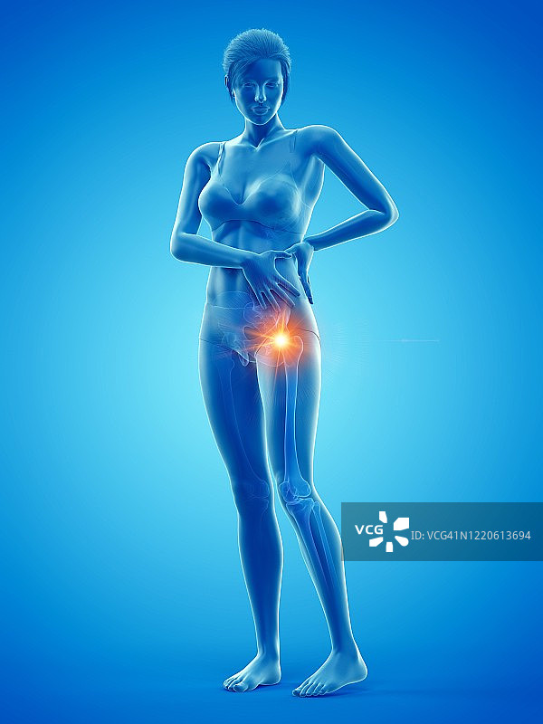 臀部疼痛的女人插画图片素材