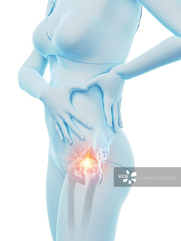 臀部疼痛的女人插画图片素材