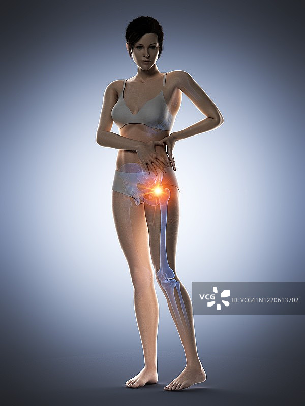 臀部疼痛的女人插画图片素材