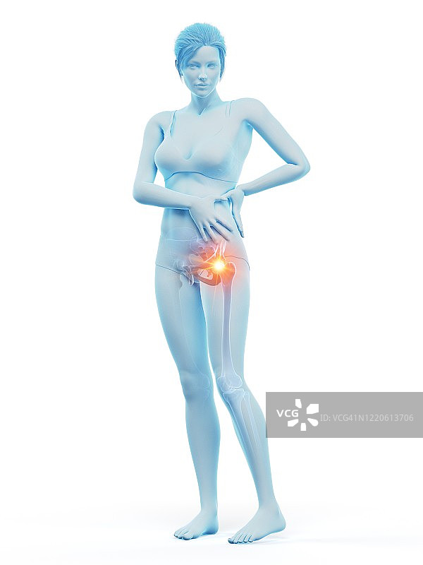 臀部疼痛的女人插画图片素材