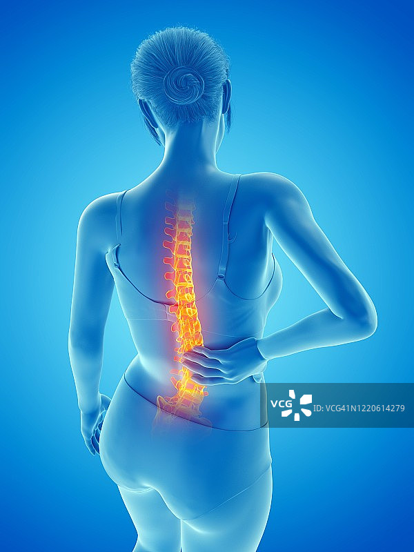 背部疼痛的女人，插图图片素材