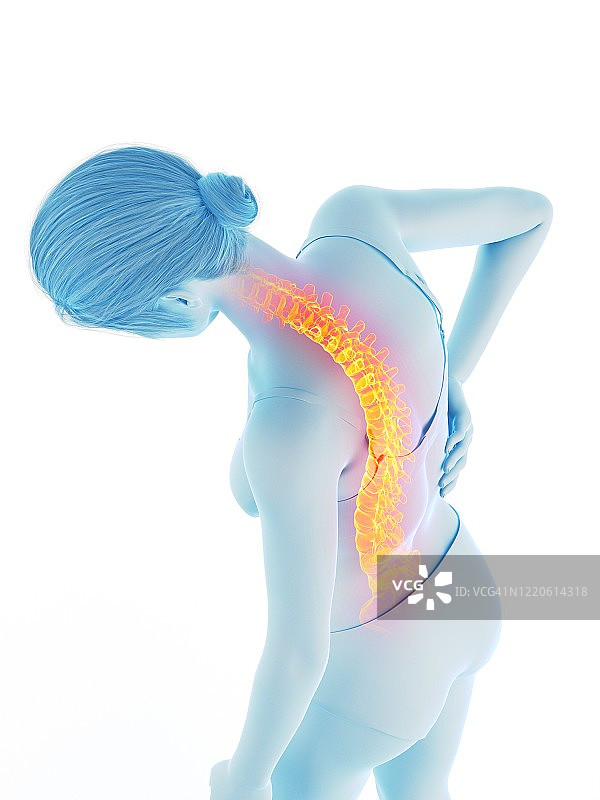 背部疼痛的女人，插图图片素材