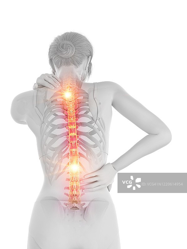 背部疼痛的女人，插图图片素材