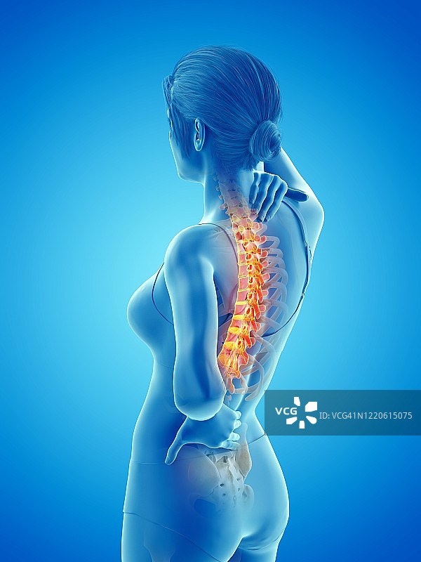 背痛的女人插画图片素材