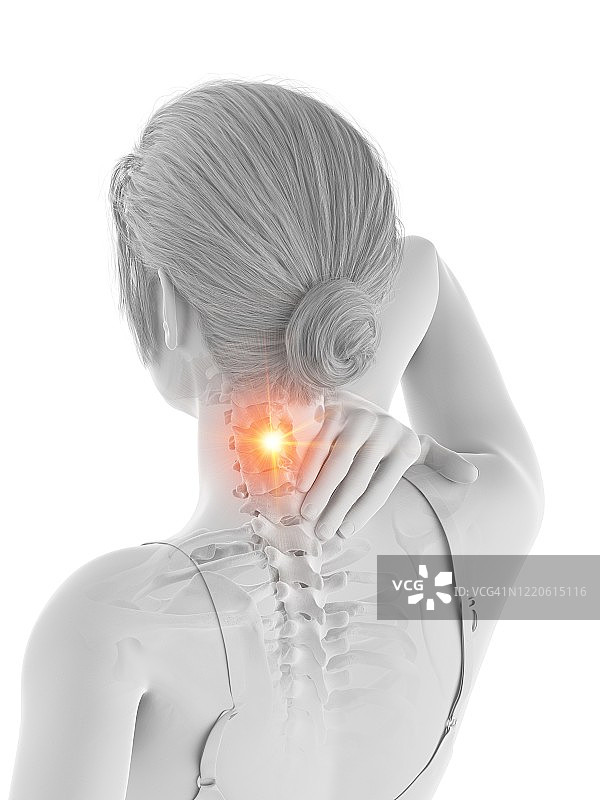 颈部疼痛的女人插画图片素材
