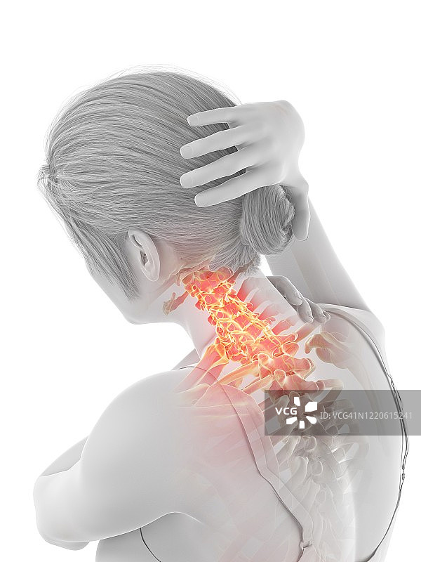 颈部疼痛的女人插画图片素材