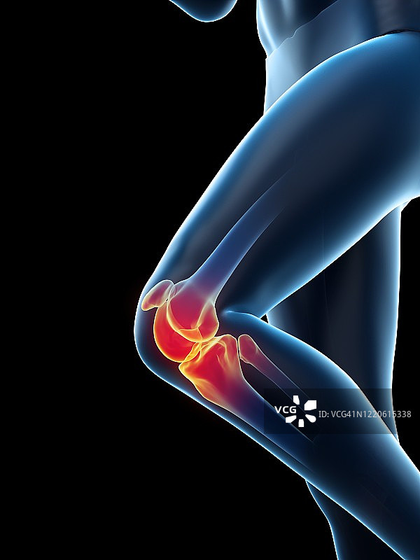 膝盖疼痛的女人插画图片素材