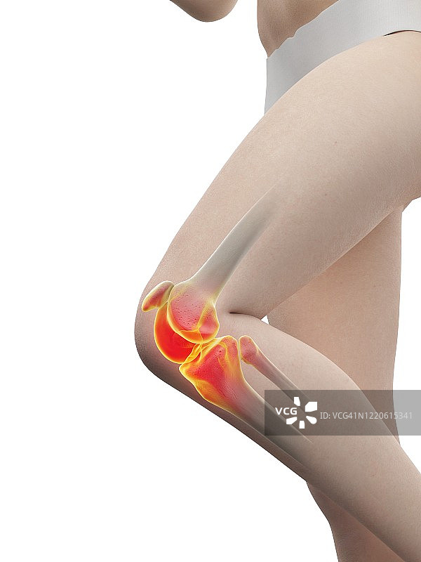 膝盖疼痛的女人插画图片素材