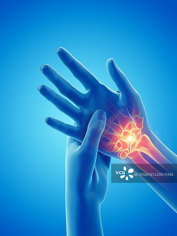 手痛的女人插画图片素材