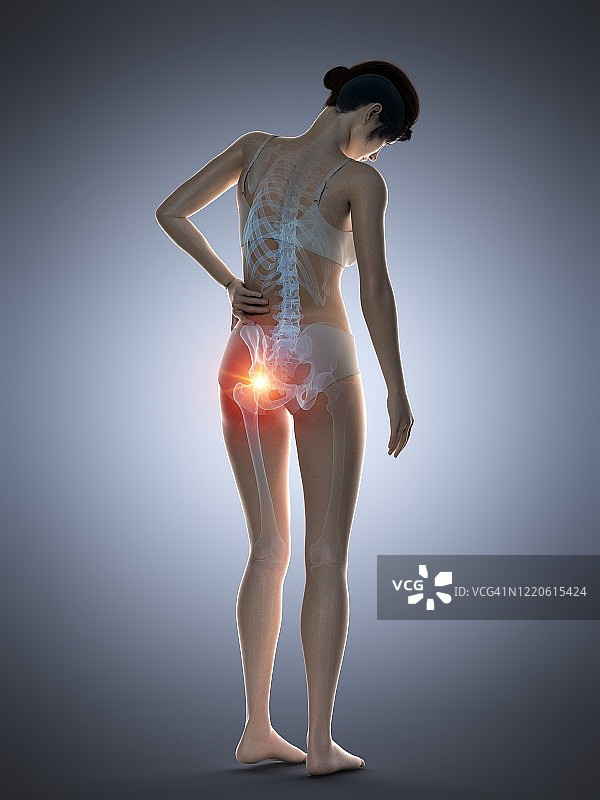 臀部疼痛的女人插画图片素材