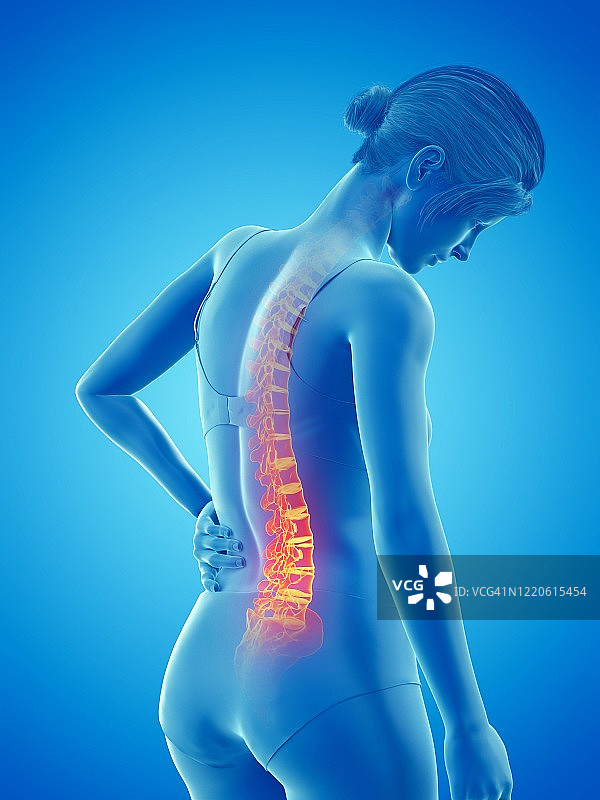 背部疼痛的女人，插图图片素材