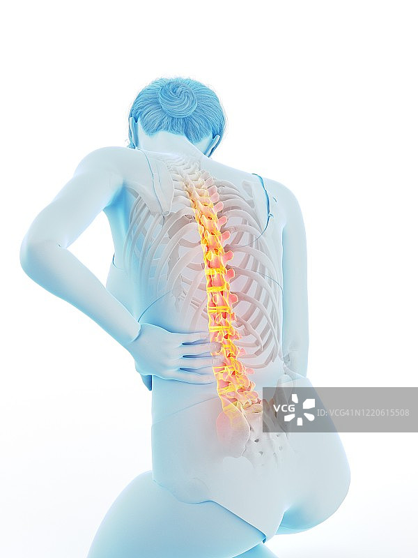 背部疼痛的女人，插图图片素材