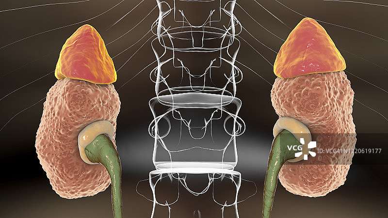 慢性肾脏疾病插图图片素材