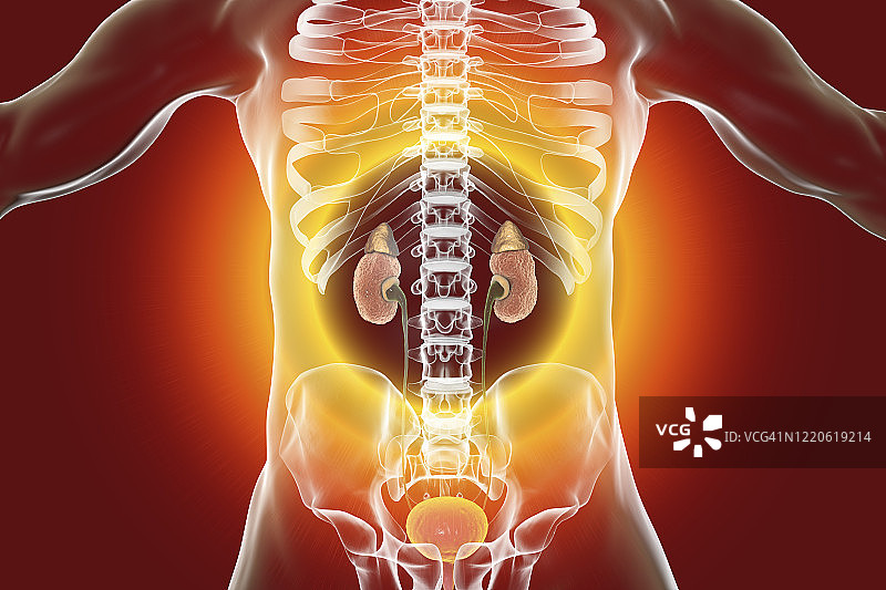 慢性肾脏疾病插图图片素材