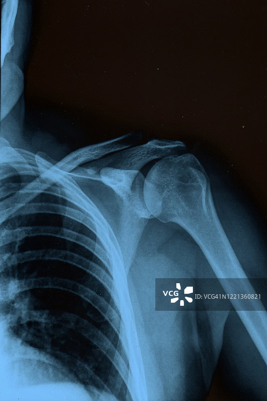 X光图像图片素材