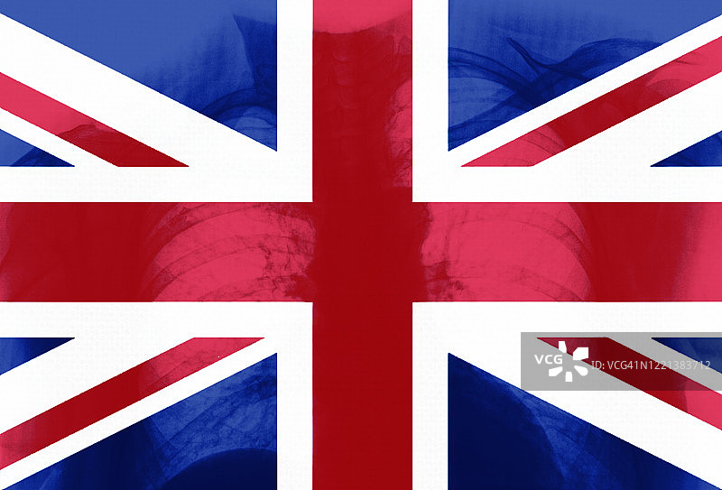 肺部X光片与英国国旗图片素材