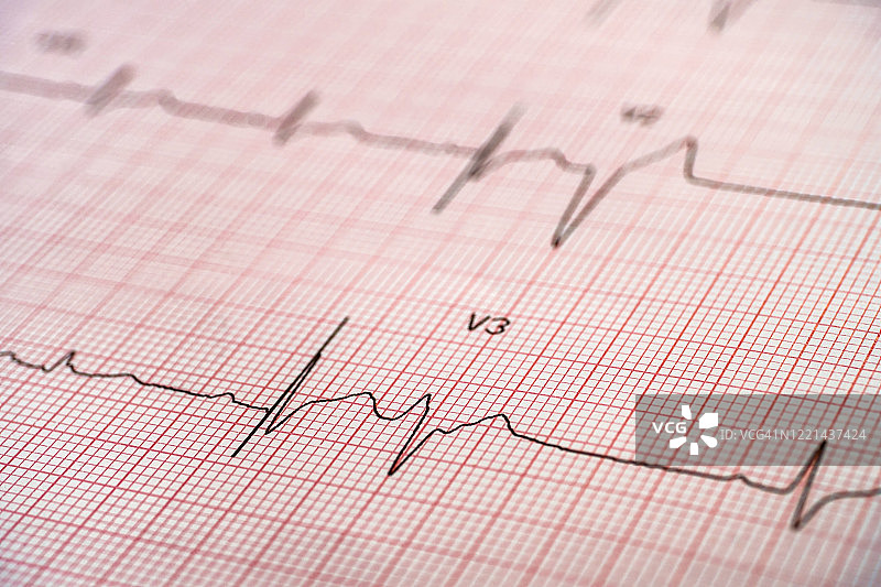 红色坐标纸上的心电图图片素材
