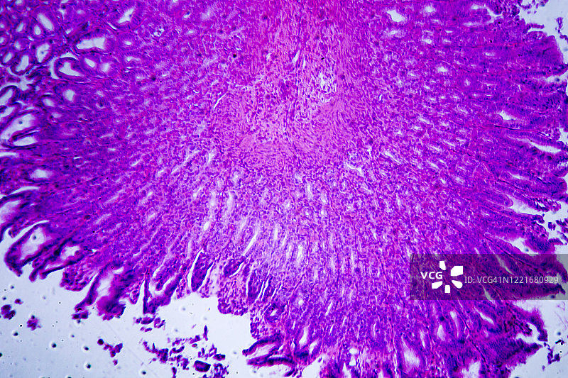 胃壁横截面显微图像图片素材