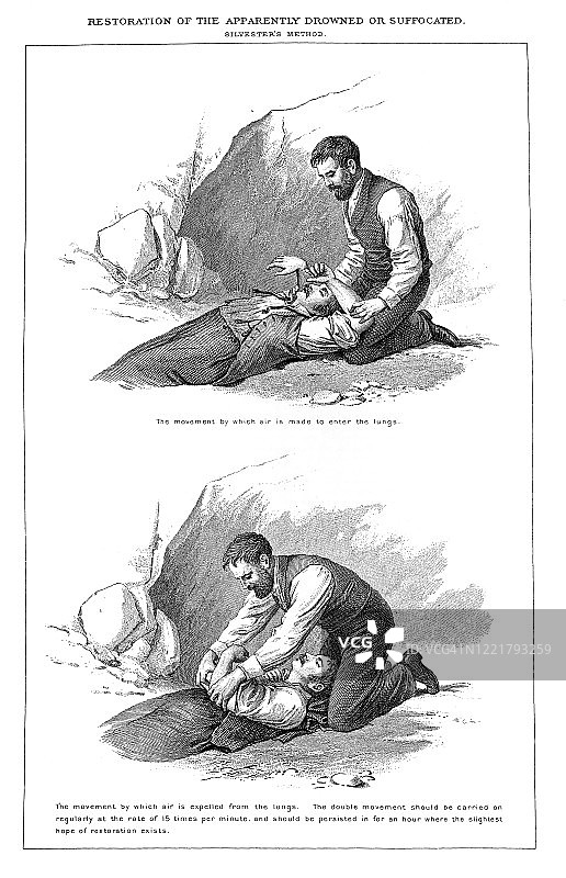 溺水或窒息的修复古老插图1894年出版的流行百科全书图片素材