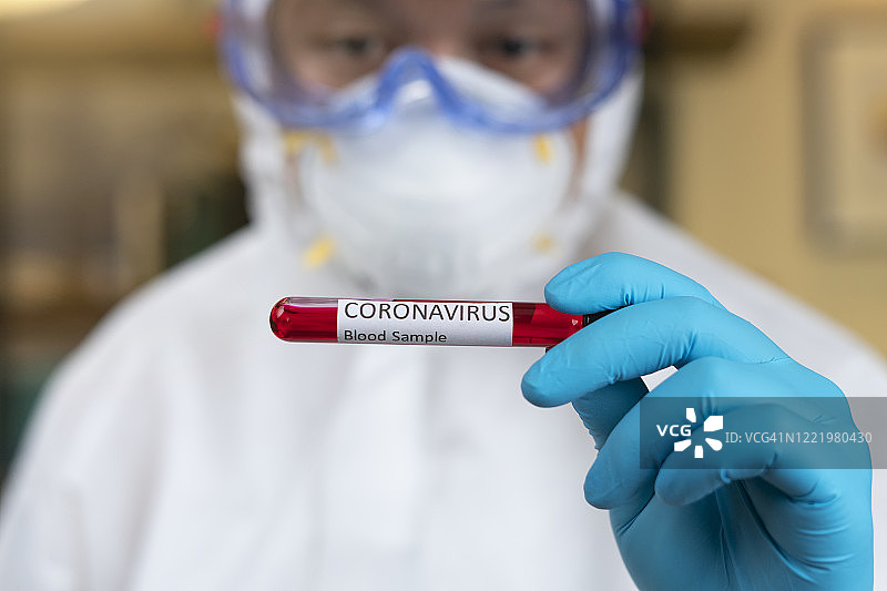 血液研究科学家与2019-nCoV冠状病毒血液样本：疫情病毒呼吸系统综合征图片素材