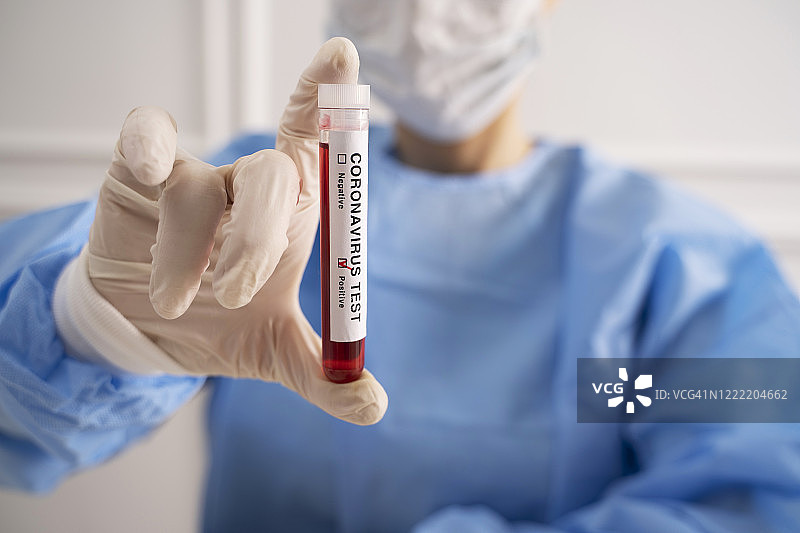 医生手持冠状病毒阳性血液样本图片素材