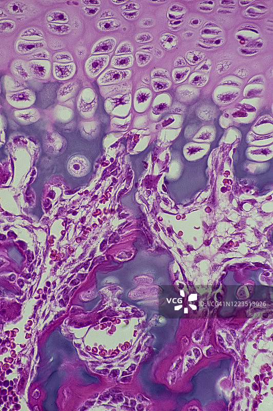 软骨内骨，软骨内骨化---骺板区域的早期骨骼发育，100倍图片素材