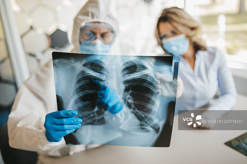 医生查看肺部X光片图片素材