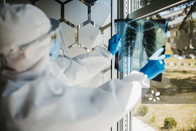 穿防护服的医生查看肺部X光片图片素材