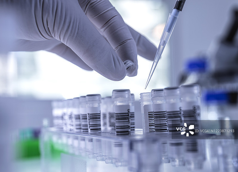 科学家戴着防护手套在实验室处理人类唾液样本图片素材