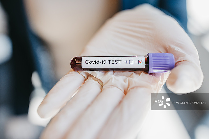 成功恢复图片素材