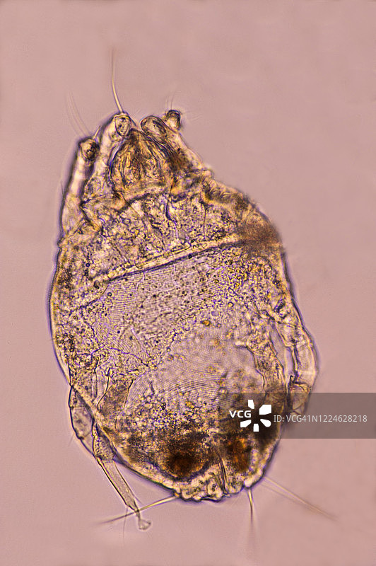 屋尘螨（Dermatophagoides），常见于室内灰尘中，是室内灰尘的过敏原（蛋白质）成分，100倍放大图片素材