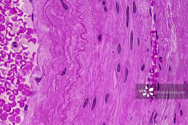 动脉显微解剖或组织学显示内膜或层，160倍图片素材